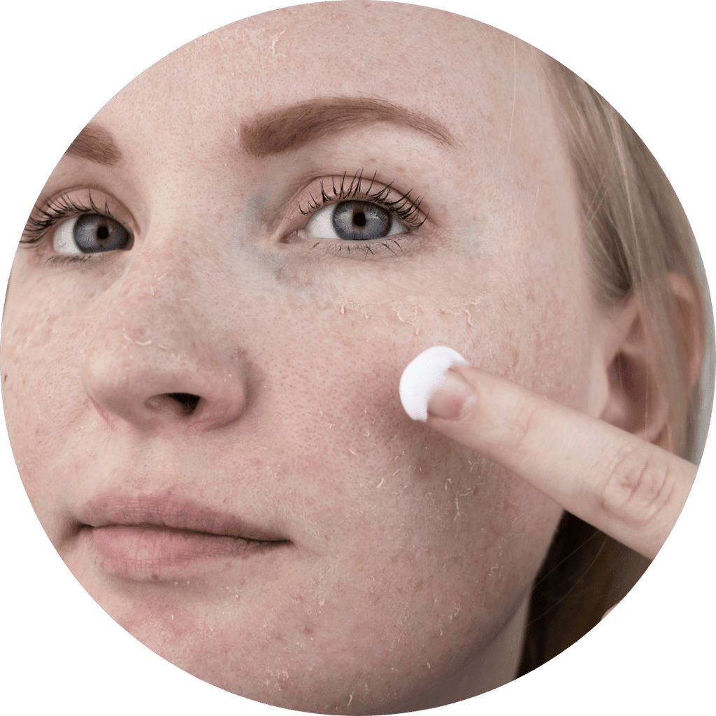 Does CBD Hemp Skincare Work?