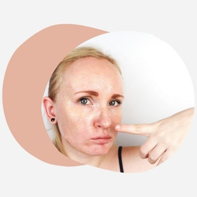 Les soins de la peau au chanvre CBD fonctionnent-ils ?